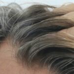 Solutions cheveux épars homme